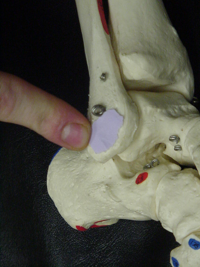 Distal end of the fibula